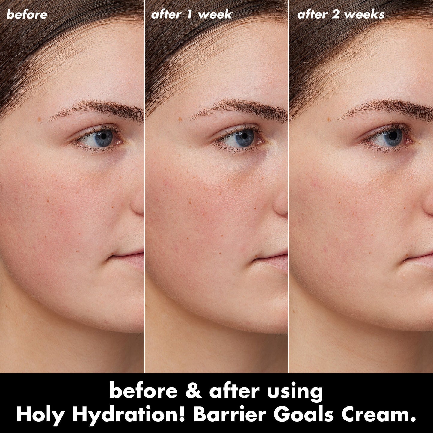 holy-hydration-barrier-goals-cream-mini-v6 0226_EDU_HHBarrierGoalsCream_B_A_Zoe_TRYPTICH_4f0e5b5d-35fb-4020-968e-244d4536afbd.jpg
