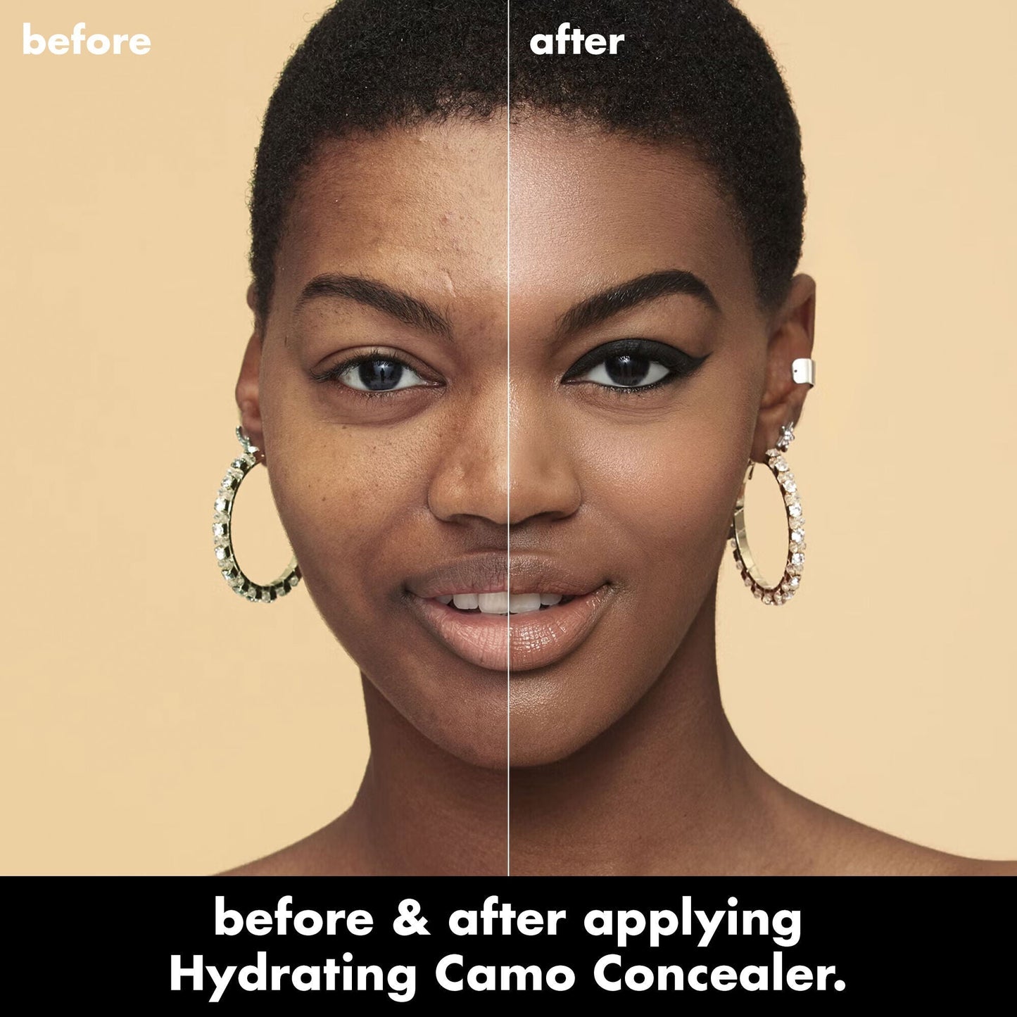hydrating-camo-concealer-z5 0226_EDU_HydratingCamoConcelaer_BA_AshleyKaresh_20_1_d8499bbf-0e91-4173-b5e2-75127caf83a3.jpg