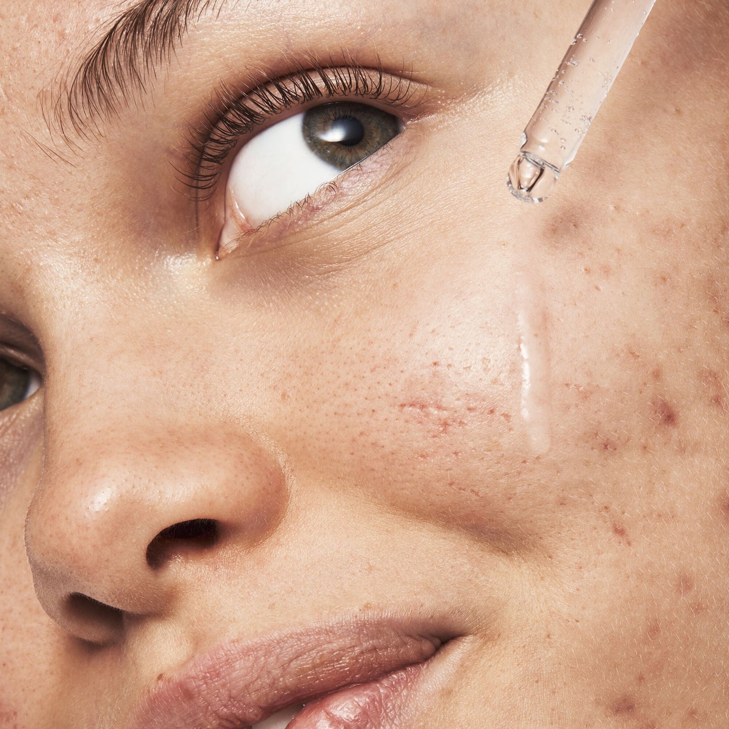 blemish-breakthrough-triple-acid-resurfacing-serum-j7 121321_Marley-Acne-Regimen_0254_FINAL_IGF.jpg