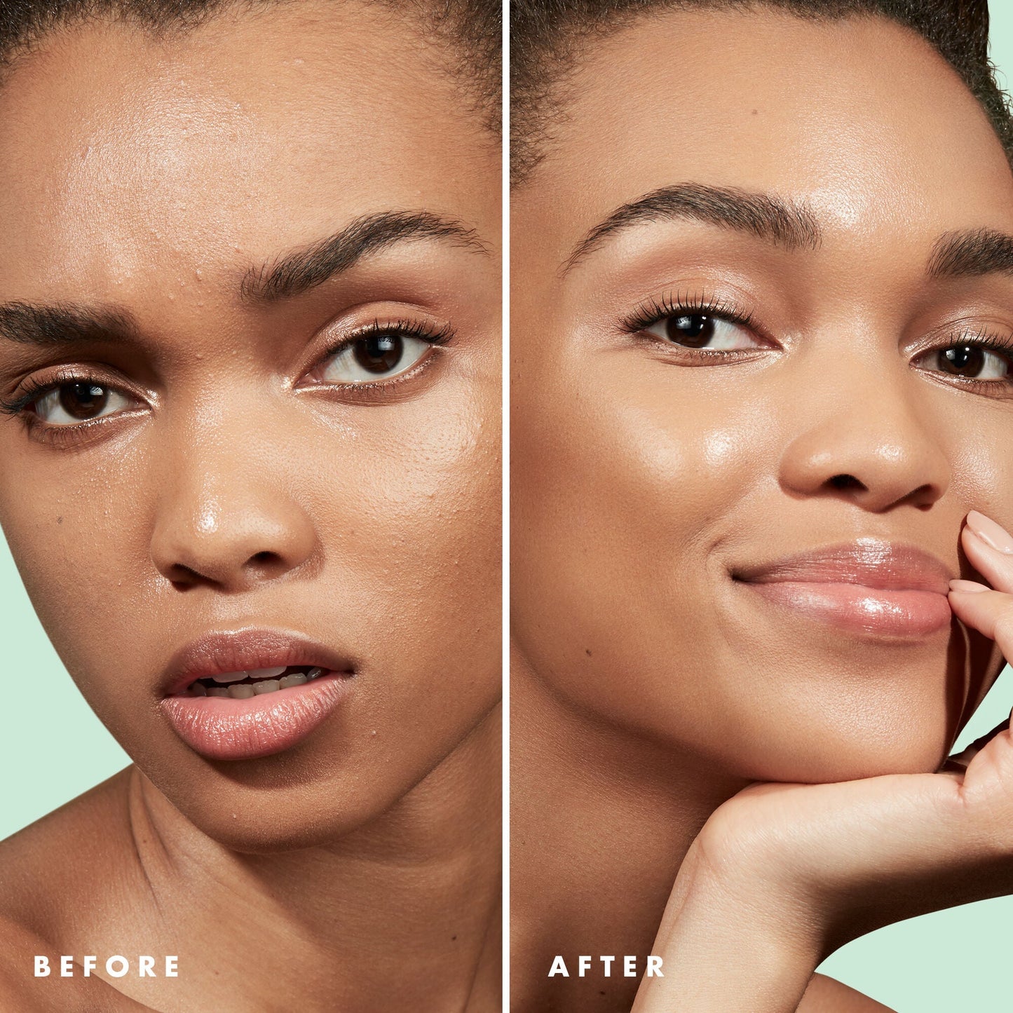blemish-control-face-primer-large-size-m7 Primer_PP_Before_After_BlemishControl_2000x2000_3774231e-d4e1-49dd-b3d7-a73cbac901fe.jpg